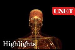 Κρυογονική – Άνθρωποι αναζητούν την αθανασία παγώνοντας τον εγκέφαλο ή το σώμα τους