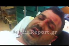 Λαμία: Έτσι με λήστεψαν - Τι είπε ο Νίκος Βέττας