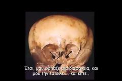 Υβρίδια εξωγήινων – ανθρώπων: Αποδείξεις υπάρχουν (Starchild)