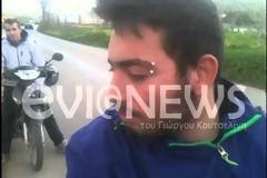 Χαλκίδα: Χαροπαλεύει 53χρονος που έπεσε σε δέντρο!