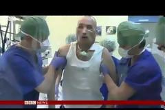 ΣΥΓΚΛΟΝΙΣΤΙΚΟ VIDEO: Η πρώτη μεταμόσχευση προσώπου στην Πολωνία