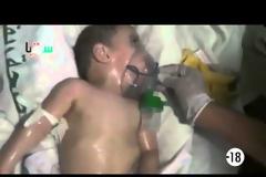 Βίντεο-ΣΟΚ από την επίθεση με χημικά στη Συρία έδωσε στη δημοσιότητα η Γαλλία - Ανατριχιαστικές εικόνες