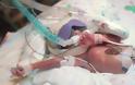 Γεννήθηκε πρόωρα αλλά βγήκε νικητής: Δείτε το συγκλονιστικό βίντεο!