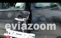 Χαλκίδα: Τραγική φιγούρα η γυναίκα που ακρωτηριάστηκε από λεωφορείο - Οι δύσκολες ώρες στο νοσοκομείο! [video]