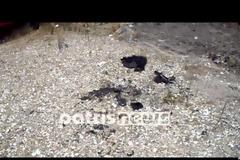 Eσπευσμένα στην Αθήνα ο αρθρογράφος της εφημερίδας Πατρίς του Πύργου που αυτοπυρπολήθηκε