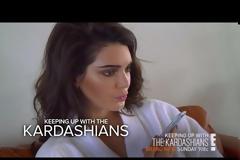 Δύσκολες ώρες για την Kendall Jenner: Η σπάνια πάθηση από την οποία πάσχει
