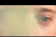 Tρομακτικό βίντεο: Έτσι βλέπει ένας άνθρωπος που χάνει την όρασή του [video]
