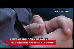 Μαρτυρία θύματος επίθεσης μετά την αντιφασιστική πορεία στο Κερατσίνι: «Με έδειραν με βαριοπούλα και με λήστεψαν» [Βίντεο]