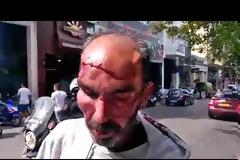 Σοβαρό επεισόδιο μεταξύ τοξικομανών στην πλατεία Όλγας - Αιμόφυρτος μπροστά στα έκπληκτα μάτια γονιών με παιδιά