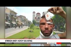 Πρωτοφανές περιστατικό: 30χρονος φοιτητής ξυλοκοπήθηκε άγρια από τρεις νεαρούς