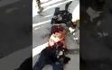 ΒΙΝΤΕΟ Αντάρτες που υποστηρίζονται από την Τουρκία βασάνισαν και ακρωτηρίασαν γυναίκα
