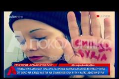 Γρηγόρης Αρναούτογλου για Αντώνη Κανάκη και Γιάννη Λάτσιο: «Αυτός είναι διευθυντής»