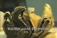 10362 - Πώς συντηρείται ένα χειρόγραφο ψαλτήρι του 14ου αιώνα (βίντεο)