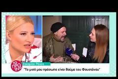 «Το μισό μου πρόσωπο είναι θαύμα του Φουστάνου»! [video]